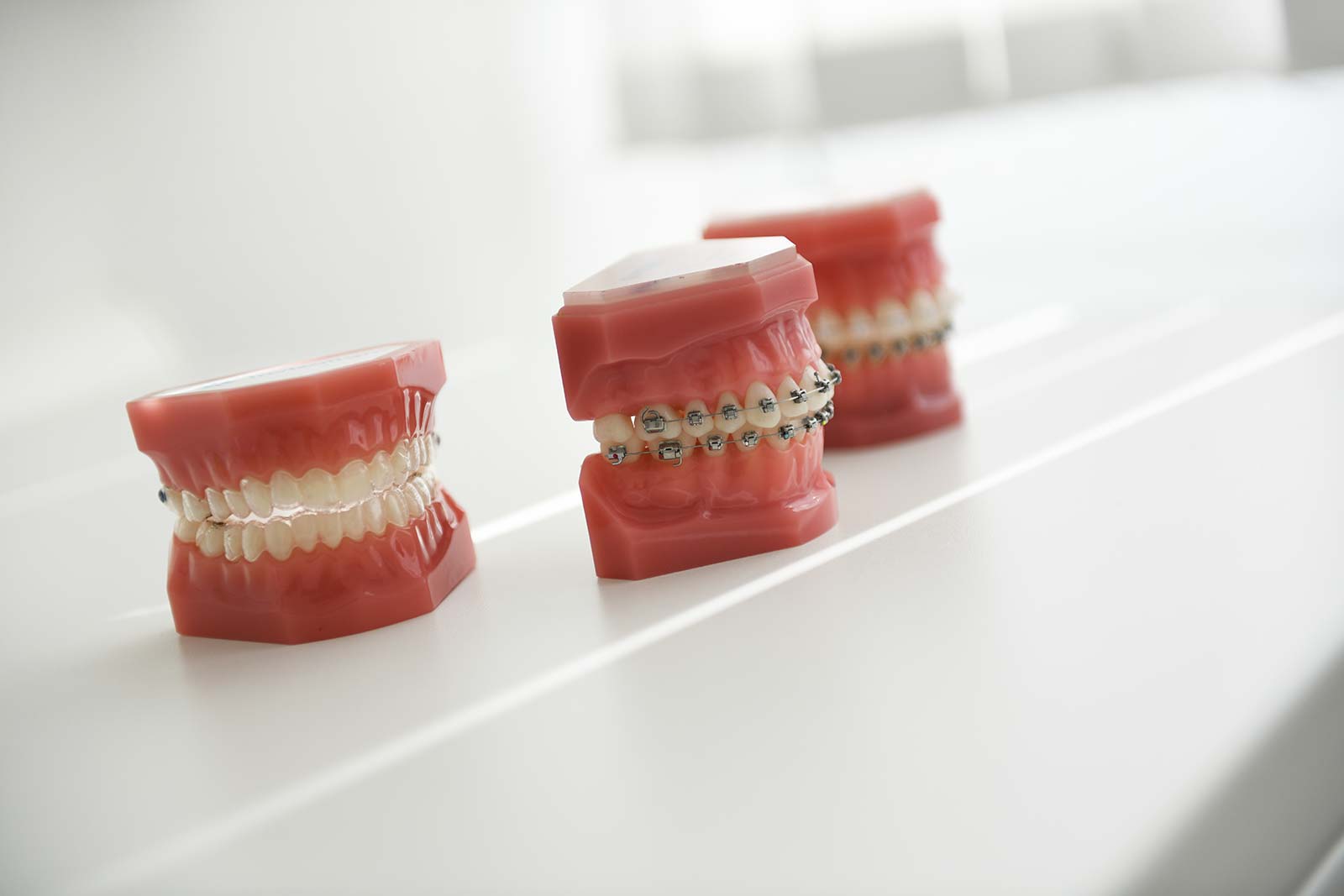 3 Gebisse zeigen beispielhaft Zahn-Brackets